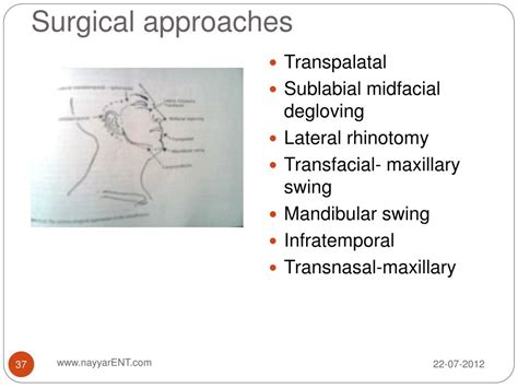 Ppt Surgical Anatomy Of The Nasopharynx Powerpoint Presentation Free