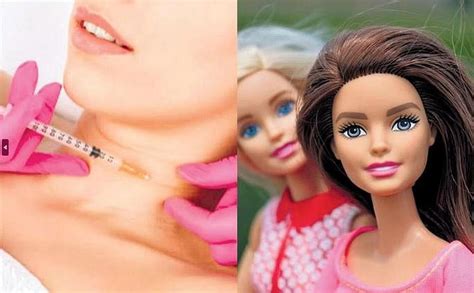 From Dolls To Humans The Rise Of Trap Tox Procedures To Get The Barbie Look