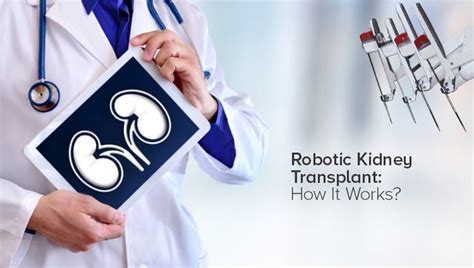 Understanding Robotic Kidney Transplant How It Works