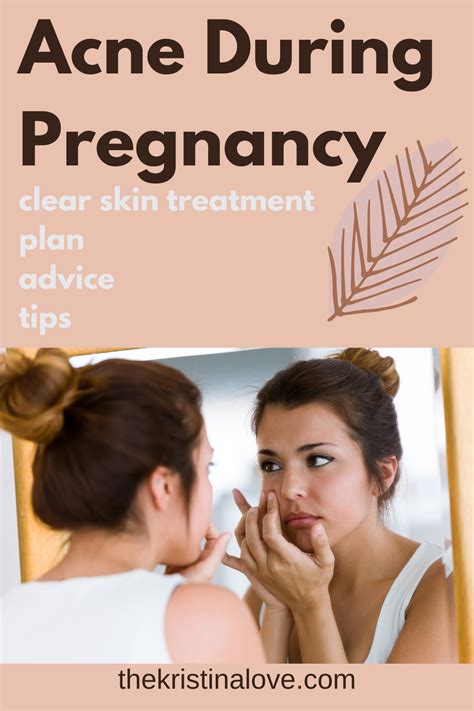 How To Treat Acne During Pregnancy Pregnancy Acne Help Acne Treatment