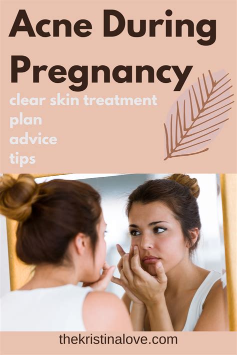 How to treat acne during pregnancy. Pregnancy acne help. Acne Treatment