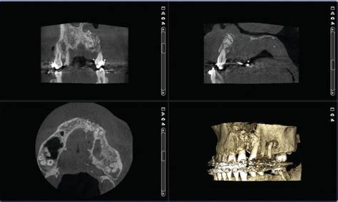 Cone Beam Computed Tomography For Oral And Maxillofacial Imaging