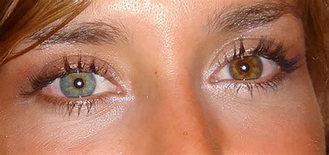 Eye Colors Total Heterochromia