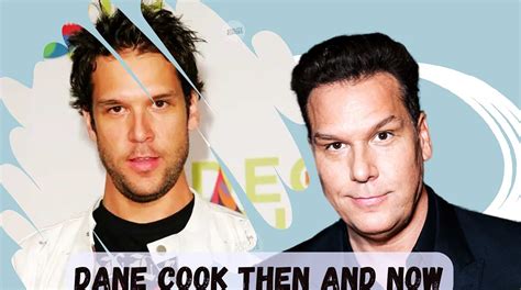 Dane Cook‘s Plastic Surgery Rumors Reveals Glowing Face Secrets