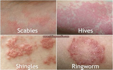Red Spots On Skin Itchy Or Not Small Pictures Causes Treatment