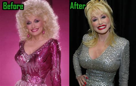 Dolly Parton: Can't Live Without Plastic Surgery ...