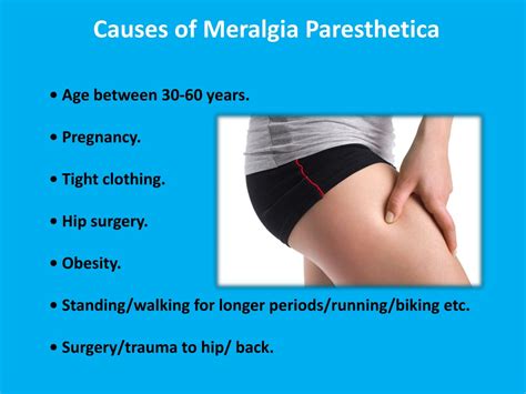 Meralgia Paresthetica Symptoms