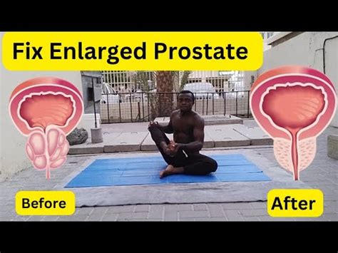 No More Prostate Problems Yoga Exercises For Men Over Youtube