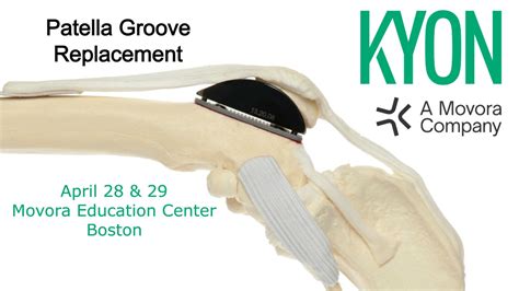 Patellar Groove Replacement Pgr Movora Education Center