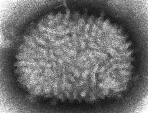 Free Picture Electron Micrograph Vaccinia Virus Virions Cells