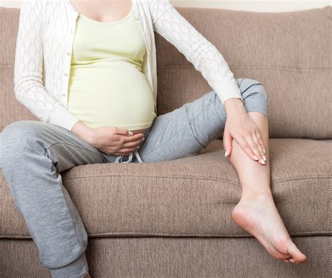 Varices En El Embarazo ¿porqué Aparecen Y Cómo Tratarlas