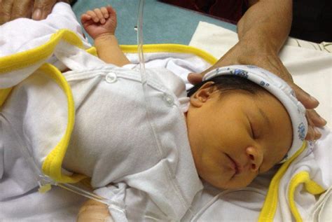 Cara Mengobati Mata Kuning Pada Bayi Baru Lahir Terkait Mata