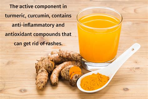 14 Home Remedies To Manage Hives Naturally Emedihealth
