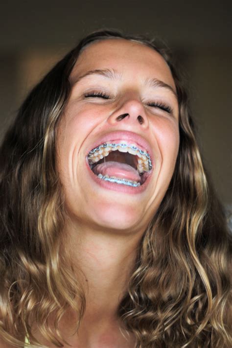 Pin By John Beeson On Girls In Braces In 2021 Braces Girls Perfect