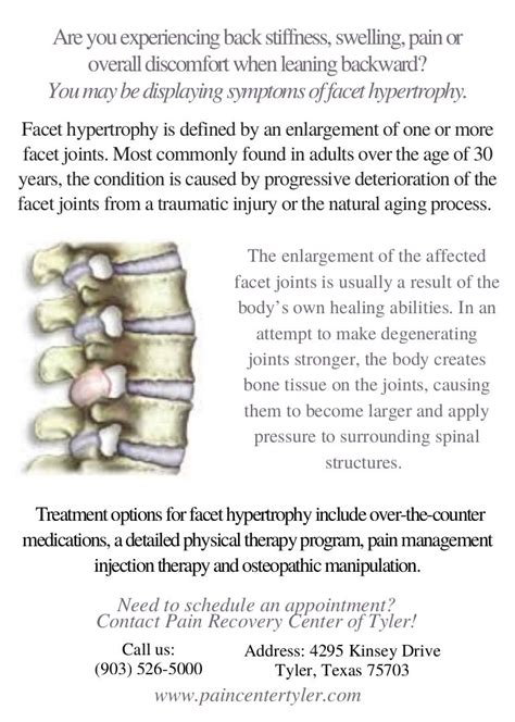 Facet Hypertrophy Pain Management Physician Tyler Tx