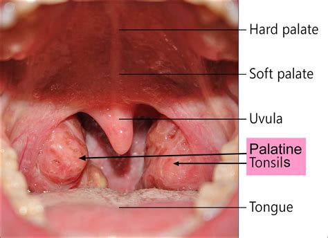 normal tonsils