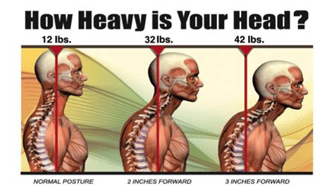 Forward Head Posturejust How Heavy Is Your Head