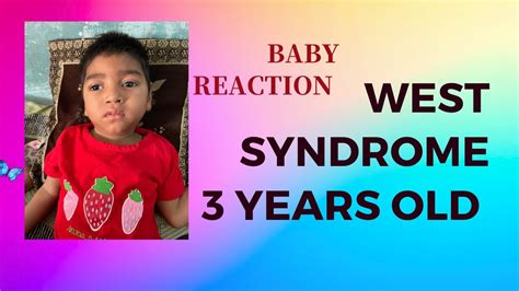 Infantile Spasms Baby Infantile Spasms Baby Video West Syndrome