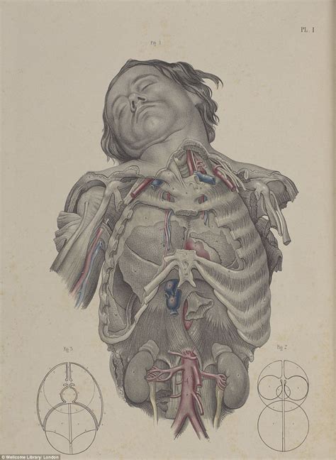 Wellcome Collections Images Show The Barbaric Nature Of 19th Century