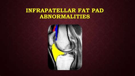 Infrapatellar Fat Pad Abnormalities Ppt