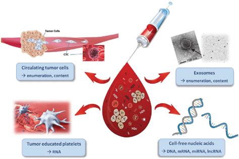 Liquid Biopsies Contain A Variety Of Clinically Informative Components