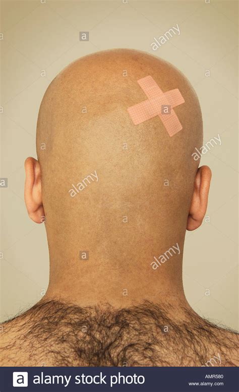 Back Of Bald Man S Head Stock Photo Royalty Free Image 2848127 Alamy