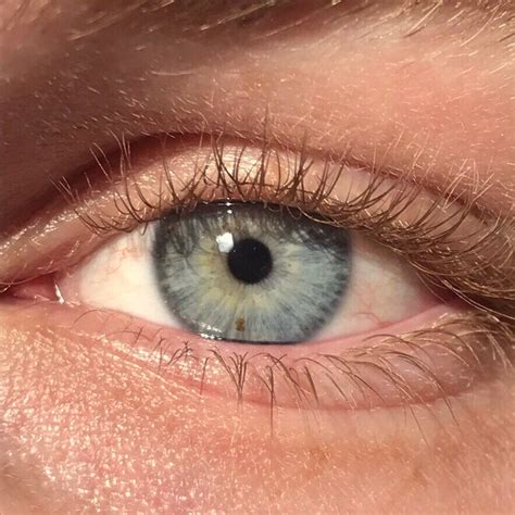 Til 99 Of People In Estonia Have Blue Eyes Todayilearned
