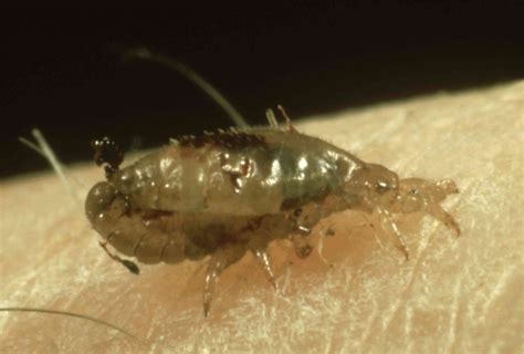 What Do Lice Look Like Pictures Of Nits Eggs And Lice