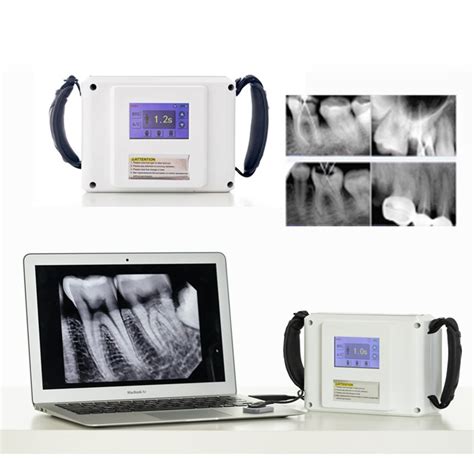 Dental X Ray Unit Xray Portable Machine Dental X Ray Equipment Opg