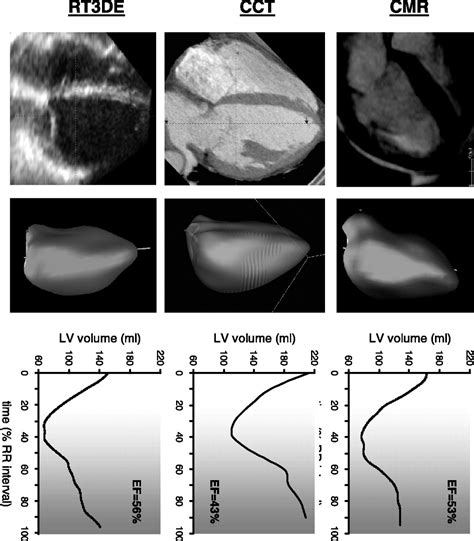 Quantitative Assessment Of Left Ventricular Size And Function Circulation