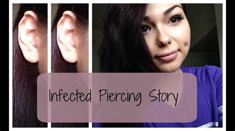 My Crazy Infected Piercing Story Nativebeauty Youtube
