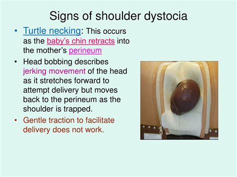 Ppt Dystocia Caused By Fetal Anomalies Powerpoint Presentation Free