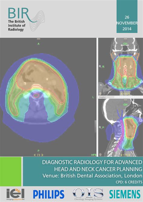 Diagnostic Radiology For Advanced Head And Neck Cancer Planning By Bir