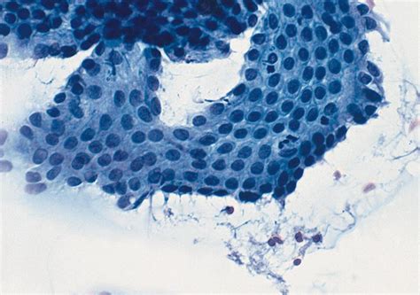 Pathology Outlines Cytology