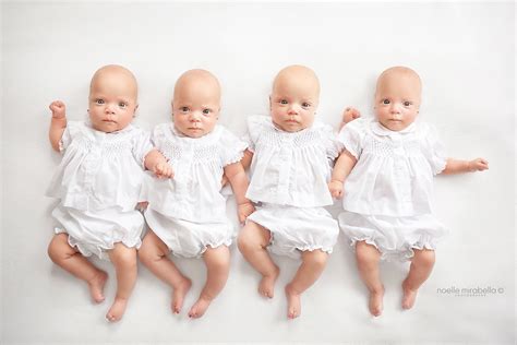 These Identical Quadruplet Baby Girls Are Growing Up Fast
