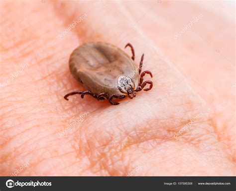 Encephalitis Or Lyme Disease Infected Tick Insect On Skin Macro Close