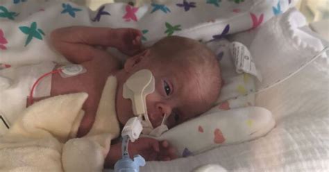 Baby Born At 26 Weeks With 50 Chance Of Survival Has Just Celebrated
