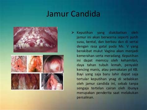 Jenis Jenis Penyakit Infeksi