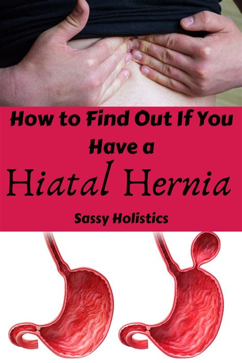 Hiatal Hernia A Hidden Cause Of Many Symptoms Migraines Remedies