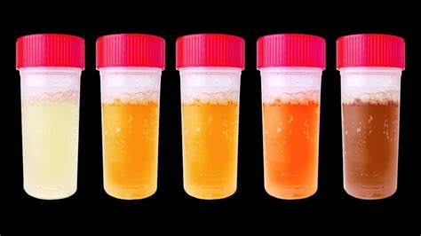 7 Things Your Pee Can Say About Your Health Orange Pee Urine Therapy