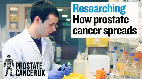 The PhD Babe Finding Out How Prostate Cancer Spreads Prostate Cancer Research YouTube