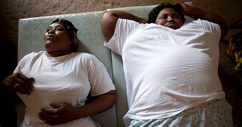 Obesity Africas New Crisis Society The Guardian