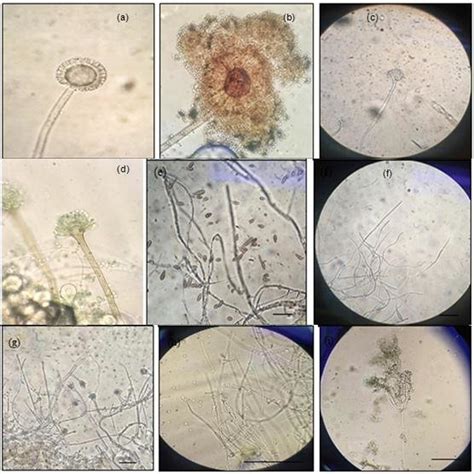 Morphology Of Different Fungi A G 40x And H I 100x Isolated From