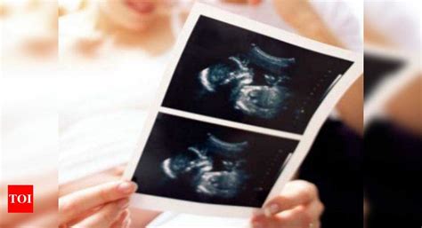 Pre Natal Diagnostic Technique Doctor Held For Conducting Sex