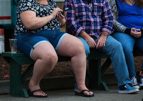 Obesity Rises Despite All Efforts To Fight It U S Health Officials Say The New York Times