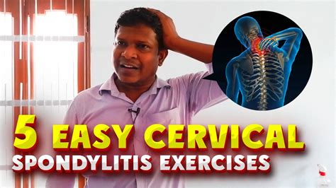 Stop Neck Pain Now Easy Cervical Spondylitis Exercises