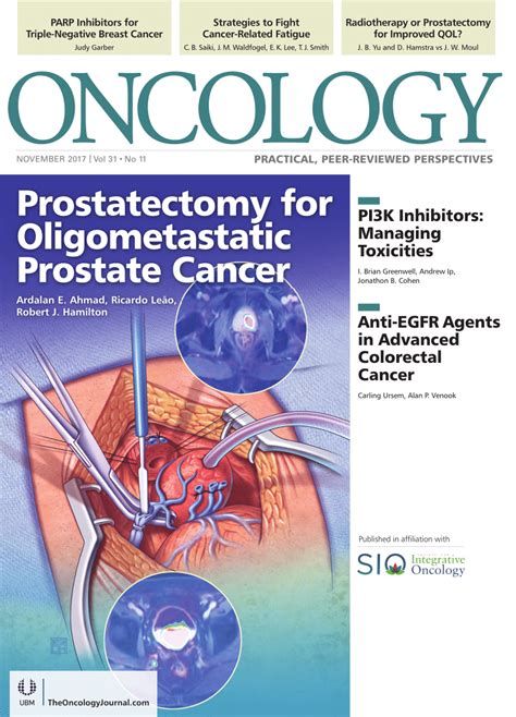Pdf Radical Prostatectomy For Patients With Oligometastatic Prostate Cancer