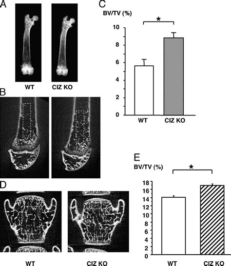 Trabecular Bone Volume Of The Femora Is Increased In Ciz Ko Mice A