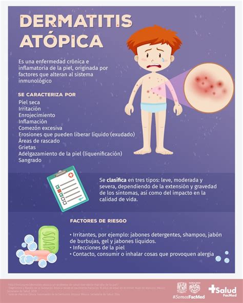 Dermatitis Atópica Una Enfermedad Frecuente En La Niñez Salud Facmed