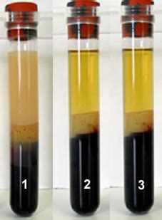 Once you understand the differences, you can better judge which is the best fit for your experiments. Untitled Document david-bender.co.uk